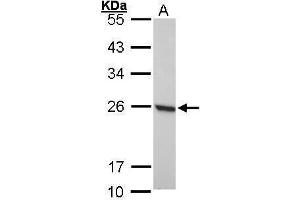 WB Image Sample (30 ug of whole cell lysate) A: 293T 12% SDS PAGE antibody diluted at 1:1000 (Peroxiredoxin 1 anticorps)