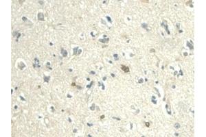 Detection of VF in Human Cerebrum Tissue using Polyclonal Antibody to Visfatin (VF) (NAMPT anticorps  (AA 1-491))