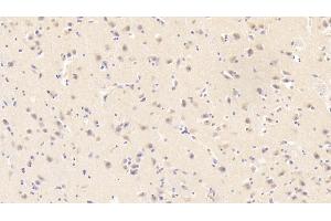 anti-Resistin (RETN) (AA 17-108) antibody