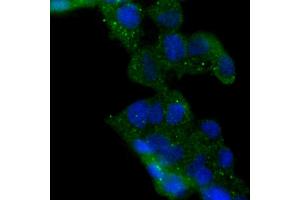 293 cells were stained with HDAC6 (6B4) Monoclonal Antibody  at 1:200 dilution, incubated overnight at 4C, followed by secondary antibody incubation, DAPI staining of the nuclei and detection. (HDAC6 anticorps)