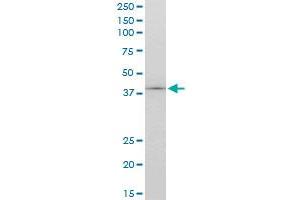 TCF2 monoclonal antibody (M06), clone 4E9.