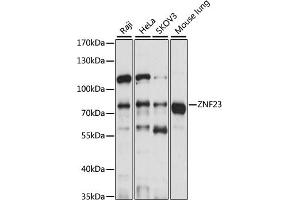 anti-Zinc Finger Protein 23 (ZNF23) (AA 1-220) antibody