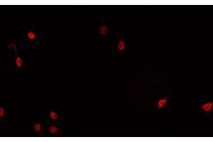 ABIN6266766 staining HeLa cells by IF/ICC. (TNFAIP8 anticorps  (Internal Region))