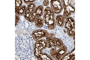 Immunohistochemical staining of human kidney with DPEP1 polyclonal antibody  shows strong cytoplasmic and membranous positivity in cells in tubules.