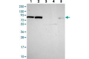 Western blot analysis of Lane 1: RT-4, Lane 2: U-251 MG, Lane 3: Human Plasma, Lane 4: Liver, Lane 5: Tonsil with DHX40 polyclonal antibody  at 1:250-1:500 dilution. (DEAH (Asp-Glu-Ala-His) Box Polypeptide 40 (DHX40) anticorps)