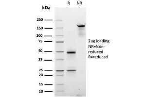 SDS-PAGE Analysis Purified Cyclin D2 Mouse Monoclonal Antibody (CCND2/2620). (Cyclin D2 anticorps)