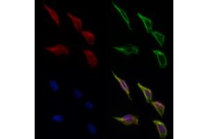 ABIN6266307 and ABIN6277426 staining Hela cells by IF/ICC. (PIBF1 anticorps  (C-Term))