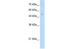 WB Suggested Anti-ZNF239 Antibody Titration:  0. (ZNF239 anticorps  (Middle Region))