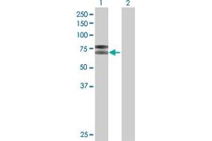 Lane 1: IL2RB transfected lysate ( 61. (IL2RB 293T Cell Transient Overexpression Lysate(Denatured))
