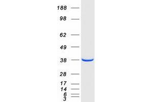 Validation with Western Blot