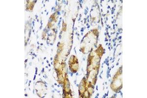 Immunohistochemistry of paraffin-embedded human gastric using N antibody (ABIN6133455, ABIN6144330, ABIN6144331 and ABIN6223249) at dilution of 1:200 (40x lens).