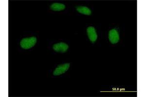 Immunofluorescence of purified MaxPab antibody to DNMT3A on HeLa cell. (DNMT3A anticorps  (AA 1-912))