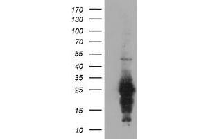 Western Blotting (WB) image for anti-Regulator of G-Protein Signaling 16 (RGS16) antibody (ABIN1500690) (RGS16 anticorps)