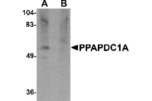 Western blot analysis of PPAPDC1A in human brain tissue lysate with PPAPDC1A antibody at 1 µg/mL in (A) the absence and (B) the presence of blocking peptide. (PPAPDC1A anticorps  (C-Term))