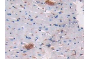 Detection of LCNL1 in Rat Heart Tissue using Polyclonal Antibody to Lipocalin Like Protein 1 (LCNL1) (LCNL1 anticorps)