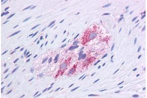 Human Colon, Myenteric Plexus: Formalin-Fixed, Paraffin-Embedded (FFPE) (GLUD1 anticorps  (AA 182-231))
