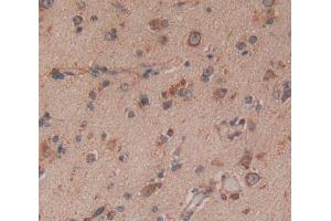 Used in DAB staining on fromalin fixed paraffin- embedded Kidney tissue (NTRK3 anticorps  (AA 32-429))
