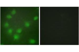 Immunofluorescence analysis of HuvEc cells, using HOXA11/D11 Antibody. (HOXA11/D11 anticorps  (AA 216-265))