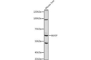 Western blot analysis of extracts of Mouse liver, using WASP Rabbit mAb (ABIN7271381) at 1:1000 dilution.