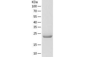 Western Blotting (WB) image for NFU1 Iron-Sulfur Cluster Scaffold (NFU1) (AA 10-254) protein (His-IF2DI Tag) (ABIN7124166)