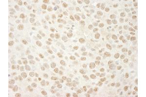 Immunohistochemistry (IHC) image for anti-SWI/SNF Related, Matrix Associated, Actin Dependent Regulator of Chromatin, Subfamily A, Member 4 (SMARCA4) (AA 75-125) antibody (ABIN7448446)