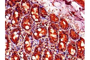 Immunohistochemistry of paraffin-embedded human small intestine tissue using ABIN7164219 at dilution of 1:100 (PFDN5 anticorps  (AA 2-154))