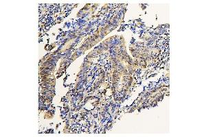 IHC analysis of ADK using anti-ADK antibody (ABIN7600222). (ADK anticorps  (AA 165-351))