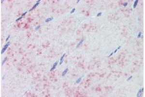 Skeletal muscle. (PDPK1 anticorps)