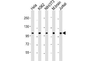 All lanes : Anti-DNM2 Antibody (N-Term) at 1:2000 dilution Lane 1: Hela whole cell lysate Lane 2: K562 whole cell lysate Lane 3: NIH/3T3 whole cell lysate Lane 4: mouse brain lysate Lane 5: Jurkat whole cell lysate Lysates/proteins at 20 μg per lane. (DNM2 anticorps  (AA 213-247))