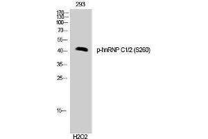 Western Blotting (WB) image for anti-Heterogeneous Nuclear Ribonucleoprotein C (C1/C2) (HNRNPC) (pSer260) antibody (ABIN3182632) (HNRNPC anticorps  (pSer260))