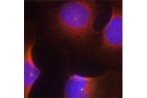 Immunofluorescence (IF) image for anti-Cyclin-Dependent Kinase 6 (CDK6) (pTyr13) antibody (ABIN1870057) (CDK6 anticorps  (pTyr13))