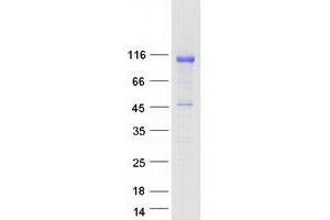 Validation with Western Blot