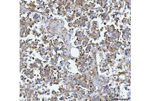 IHC analysis of MIM/MTSS1 using anti-MIM/MTSS1 antibody (ABIN7600276). (MTSS1 anticorps  (AA 17-692))