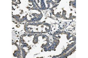 IHC analysis of FIS1 using anti-FIS1 antibody (ABIN7598965). (Fission 1 anticorps  (AA 1-121))