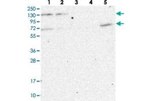 Western blot analysis of Lane 1: RT-4, Lane 2: U-251 MG, Lane 3: Human Plasma, Lane 4: Liver, Lane 5: Tonsil with MATR3 polyclonal antibody .