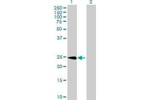 Western Blot analysis of CPSF4 expression in transfected 293T cell line by CPSF4 MaxPab polyclonal antibody.