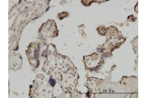Image no. 3 for anti-Zic Family Member 4 (ZIC4) (AA 249-320) antibody (ABIN466252) (ZIC4 anticorps  (AA 249-320))
