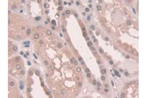 Detection of NOX1 in Human Kidney Tissue using Polyclonal Antibody to Nicotinamide Adenine Dinucleotide Phosphate Oxidase 1 (NOX1) (NOX1 anticorps  (AA 235-488))