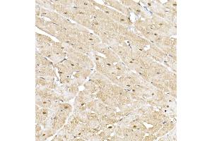 Immunohistochemistry of paraffin-embedded rat heart using PSM Rabbit pAb (752) at dilution of 1:50 (40x lens).