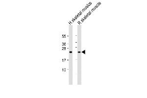 All lanes : Anti-MYL1 Antibody (N-Term) at 1:2000 dilution Lane 1: Human skeletal muslce lysate Lane 2: Rat skeletal muscle lysate Lysates/proteins at 20 μg per lane. (MYL1 anticorps  (AA 24-58))