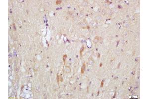 Formalin-fixed and paraffin embedded rat brain labeled with Rabbit Anti-Slitrk1 Polyclonal Antibody, Unconjugated (ABIN715556) at 1:200 followed by conjugation to the secondary antibody and DAB staining (SLITRK1 anticorps  (AA 21-120))