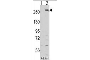 Western blot analysis of LMTK2 (arrow) using rabbit polyclonal LMTK2 Antibody (Center) (ABIN391210 and ABIN2841289).