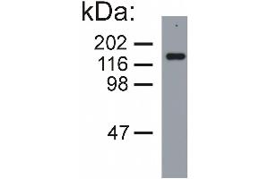 Western blotting analysis of neurofilament medium protein in porcine brain lysate (reducing conditions) by mouse monoclonal NF-09.