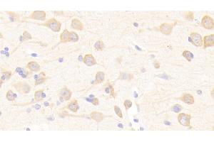Detection of CFI in Human Cerebrum Tissue using Polyclonal Antibody to Complement Factor I (CFI)