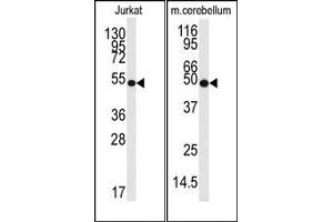 Image no. 1 for anti-Enolase 2 (Gamma, Neuronal) (ENO2) antibody (ABIN357944) (ENO2/NSE anticorps)