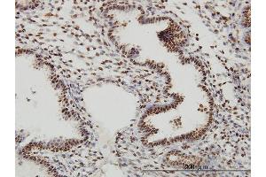 Immunoperoxidase of monoclonal antibody to SP1 on formalin-fixed paraffin-embedded human endometrium. (SP1 anticorps  (AA 89-198))