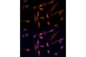 Immunofluorescence analysis of NIH/3T3 cells using STK24 Rabbit pAb (ABIN6132364, ABIN6148602, ABIN6148603 and ABIN6214875) at dilution of 1:250 (40x lens).