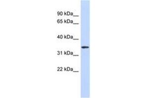 Image no. 1 for anti-Olfactory Receptor, Family 13, Subfamily C, Member 5 (OR13C5) (AA 71-120) antibody (ABIN6742326)
