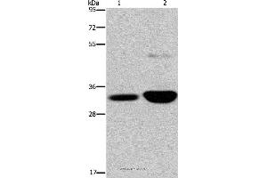 Western blot analysis of Human fetal brain and mouse brain tissue, using MAPRE3 Polyclonal Antibody at dilution of 1:500 (MAPRE3 anticorps)