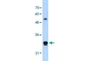Western Blot analysis of HepG2 cell lysate with IGSF1 polyclonal antibody  at 1. (IGSF1 anticorps  (N-Term))